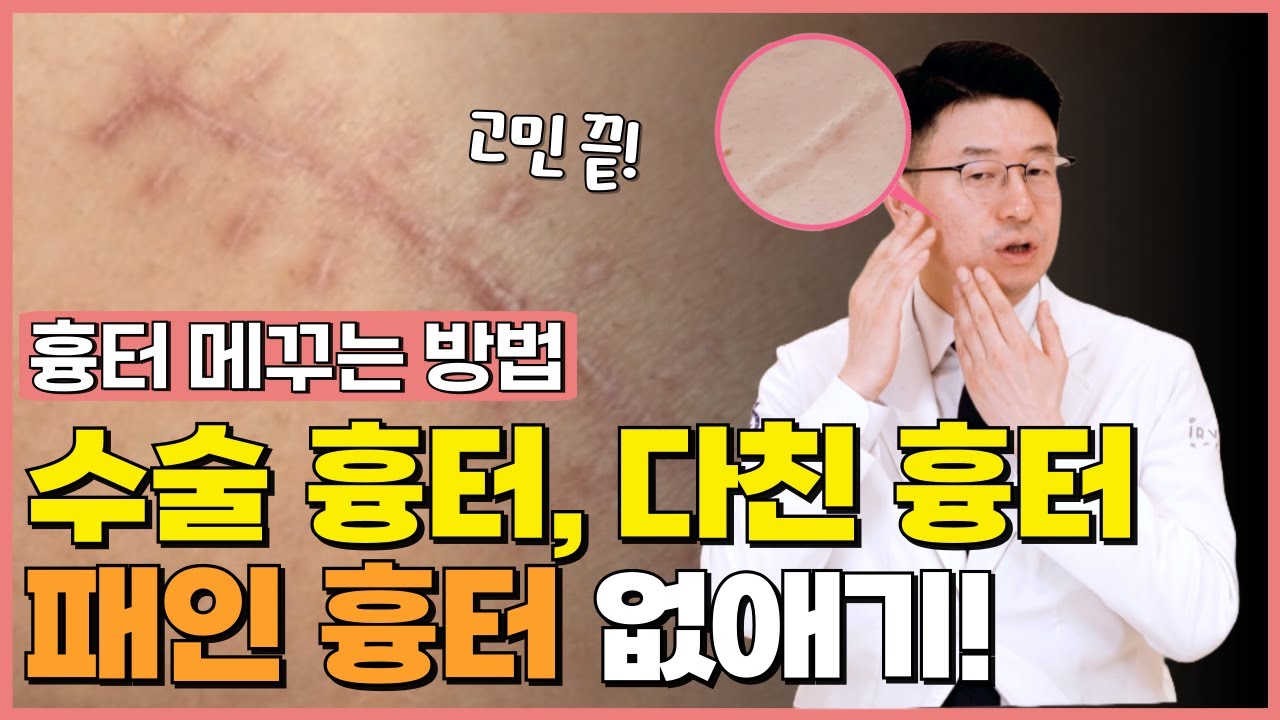 콜라겐 시술이 답? 얼굴에 패인 흉터 없애는 방법! 수술 흉터, 손톱 흉터, 수두 흉터 치료