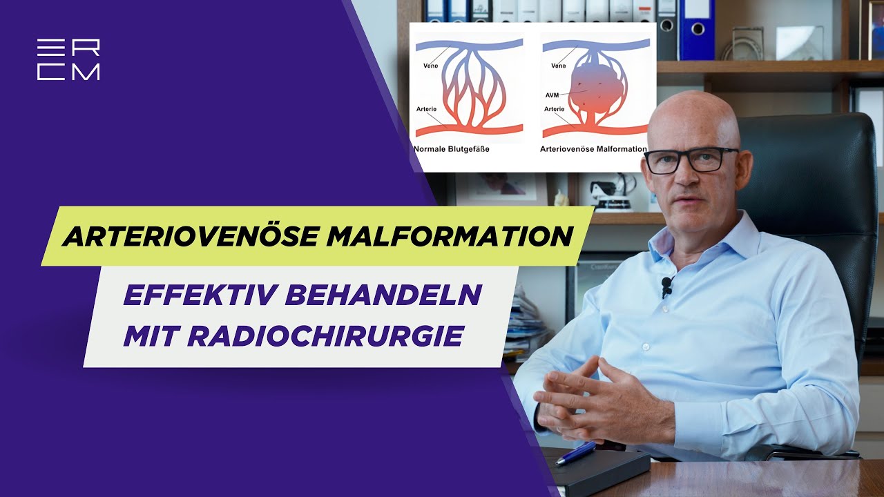 Arteriovenöse Malformation (AVM) effektiv behandeln mit Radiochirurgie