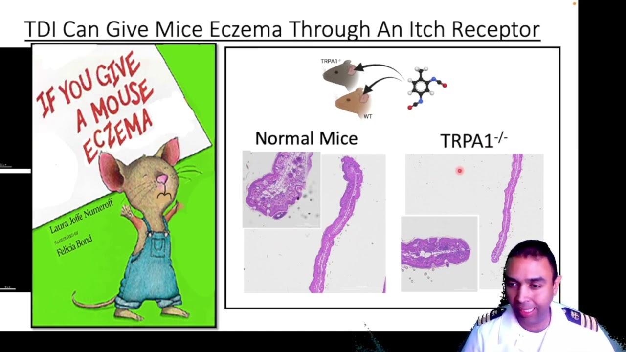 Eczema Comes From Air Pollution: Long Version