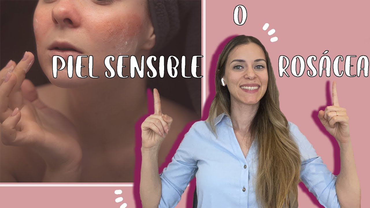 Tengo Rosácea o piel sensible? | Dermatóloga explica.