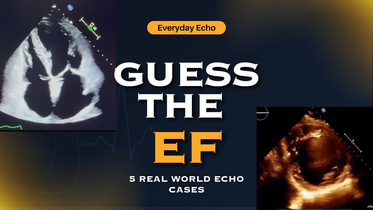 Guess the EF: 5 Real Echo Cases to Test Your Echocardiography Skills (Visual Ejection Fraction)