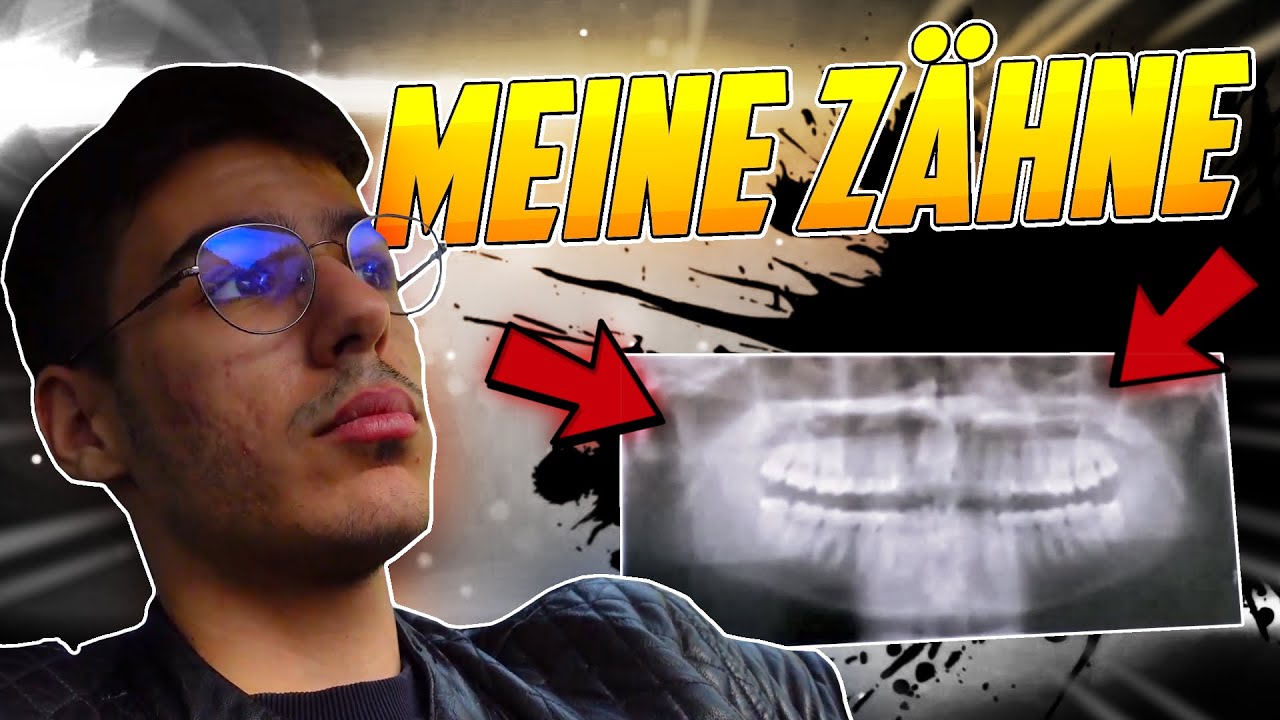 Ich musste zum Zahnarzt und hab ZWEI Spritzen bekommen 😲😞 | Vlog