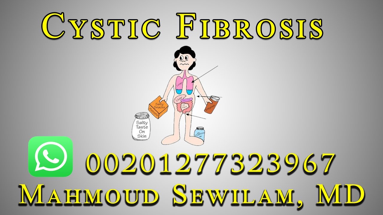شرح باطنة د سويلم Cystic Fibrosis
