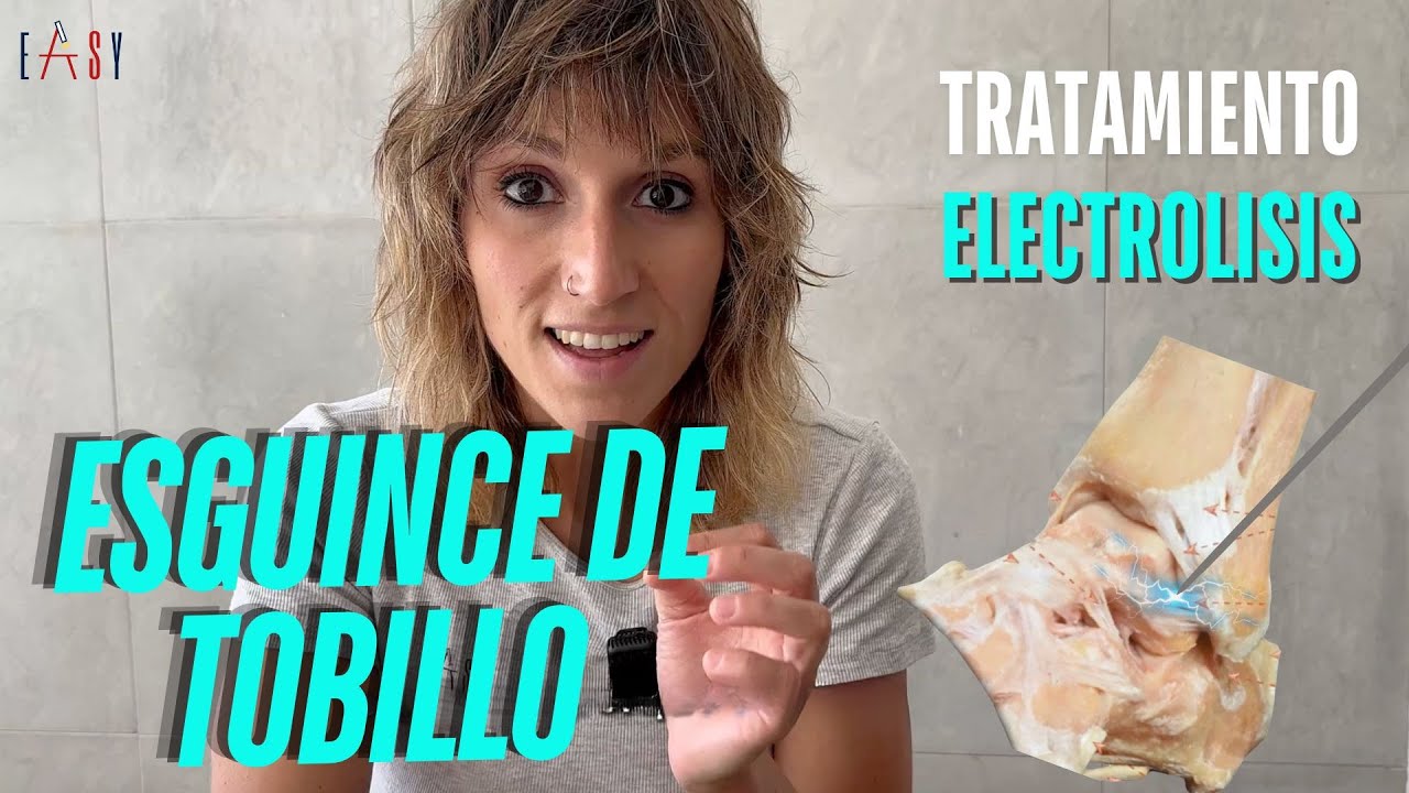 EASY #49 ¿HAS  HECHO ESTO? TRATAMIENTO INVASIVO de un  ESGUINCE DE TOBILLO🤓