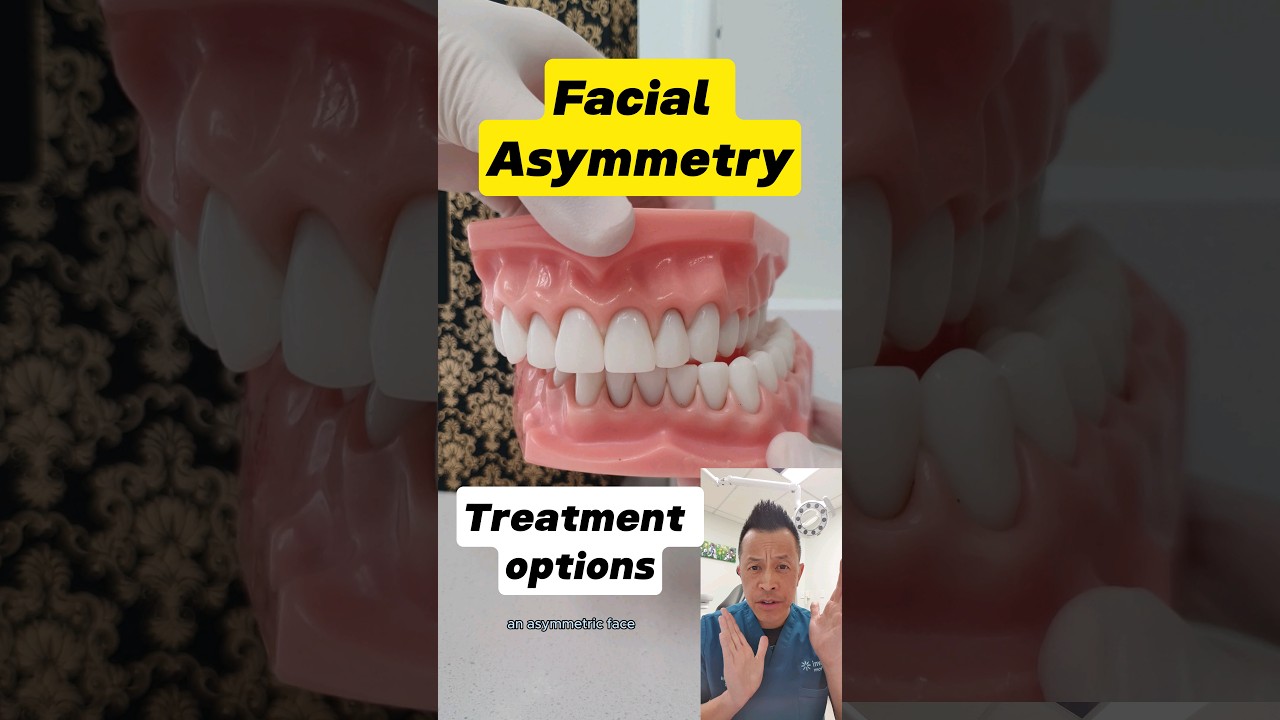Facial Asymmetry Treatment: What Are Your Options? 