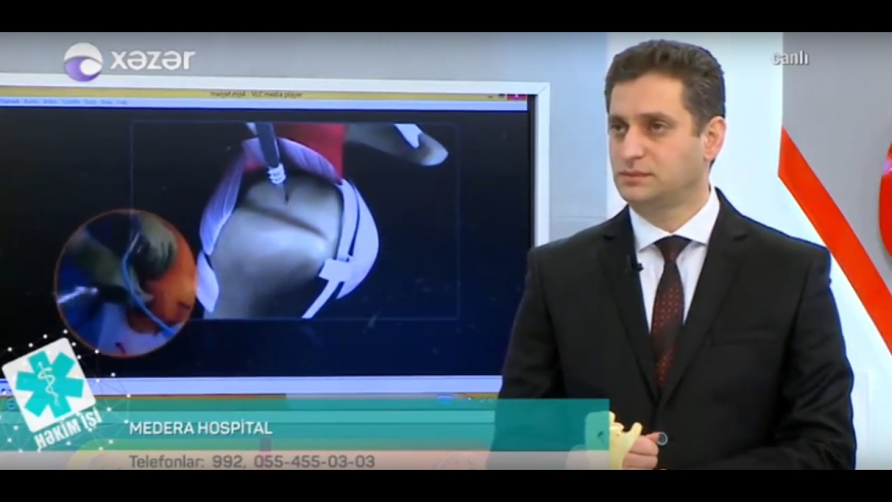 Xəzər tv Həkim işi 17.02.2017. Cərrah Travmatoloq - Ortoped Ceyhun İsmayılov.  İdman travmaları.