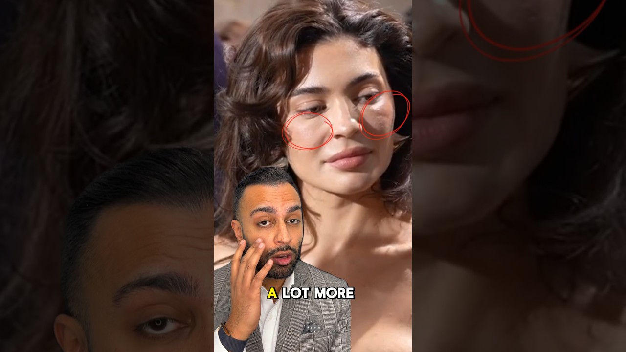 KYLIE JENNER FACE TRANSFORMATION 😱