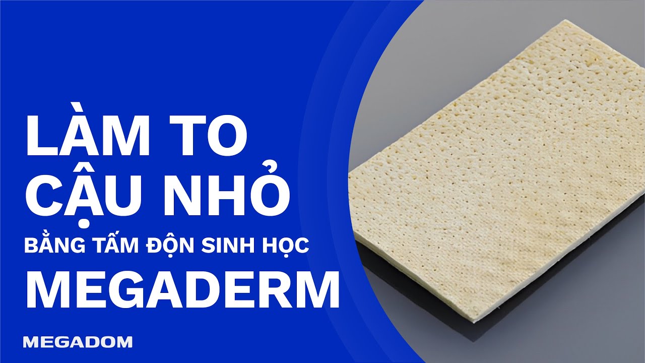 Tăng 5cm Kích Thước Dương Vật Vĩnh Viễn Bằng Miếng Độn Dương Vật Megaderm |  Phẫu Thuật To Dương Vật