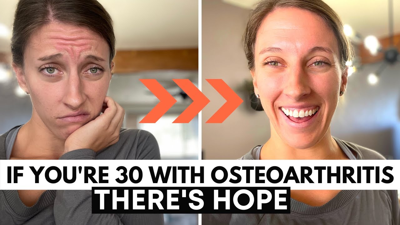 Osteoarthritis in your 20s or 30s, THERE IS HOPE | Arthritis Young Age