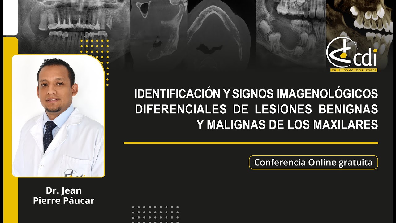 IDENTIFICACIÓN Y SIGNOS IMAGENOLÓGICO DIFERENCIALES DE LESIONES BENIGNAS Y MALIGNAS DE LOS MAXILARES