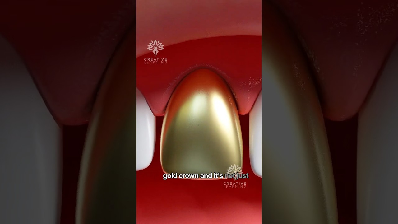 Why Do Some People Prefer Gold Tooth Over Porcelain? 🤔 #short #goldtooth- Creativelearning3d