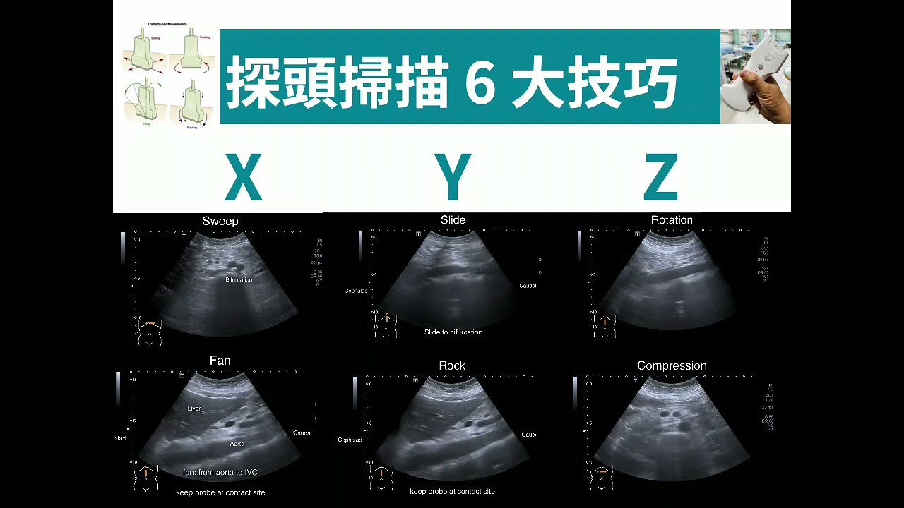 20251003 雙和急診超音波教學-hepatobiliary system (part 1)