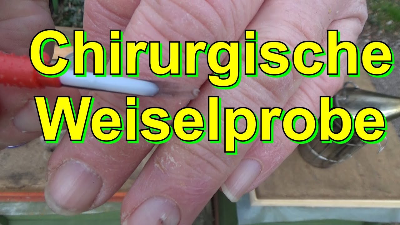 Chirurgische Weiselprobe