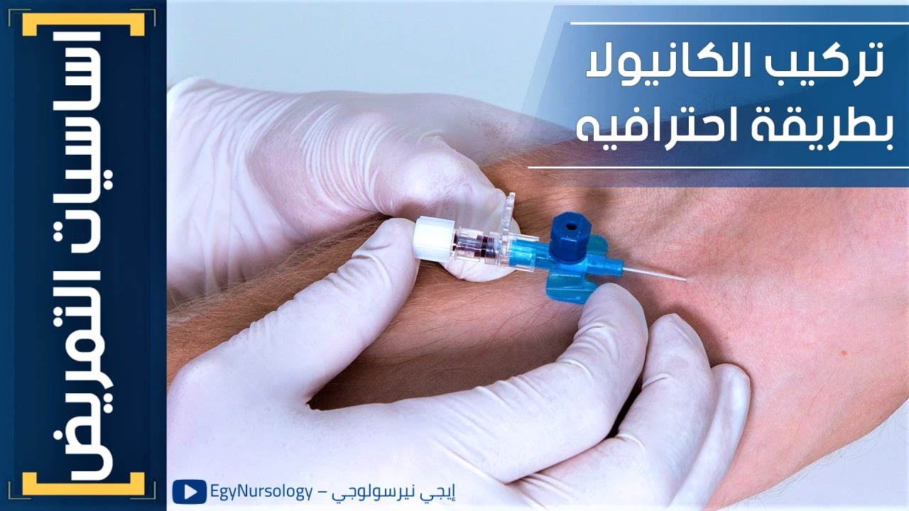 اساسيات التمريض | (12) إزاي تركب الكانيولا الطرفية بطريقة احترافية - I.V Cannulation Procedure