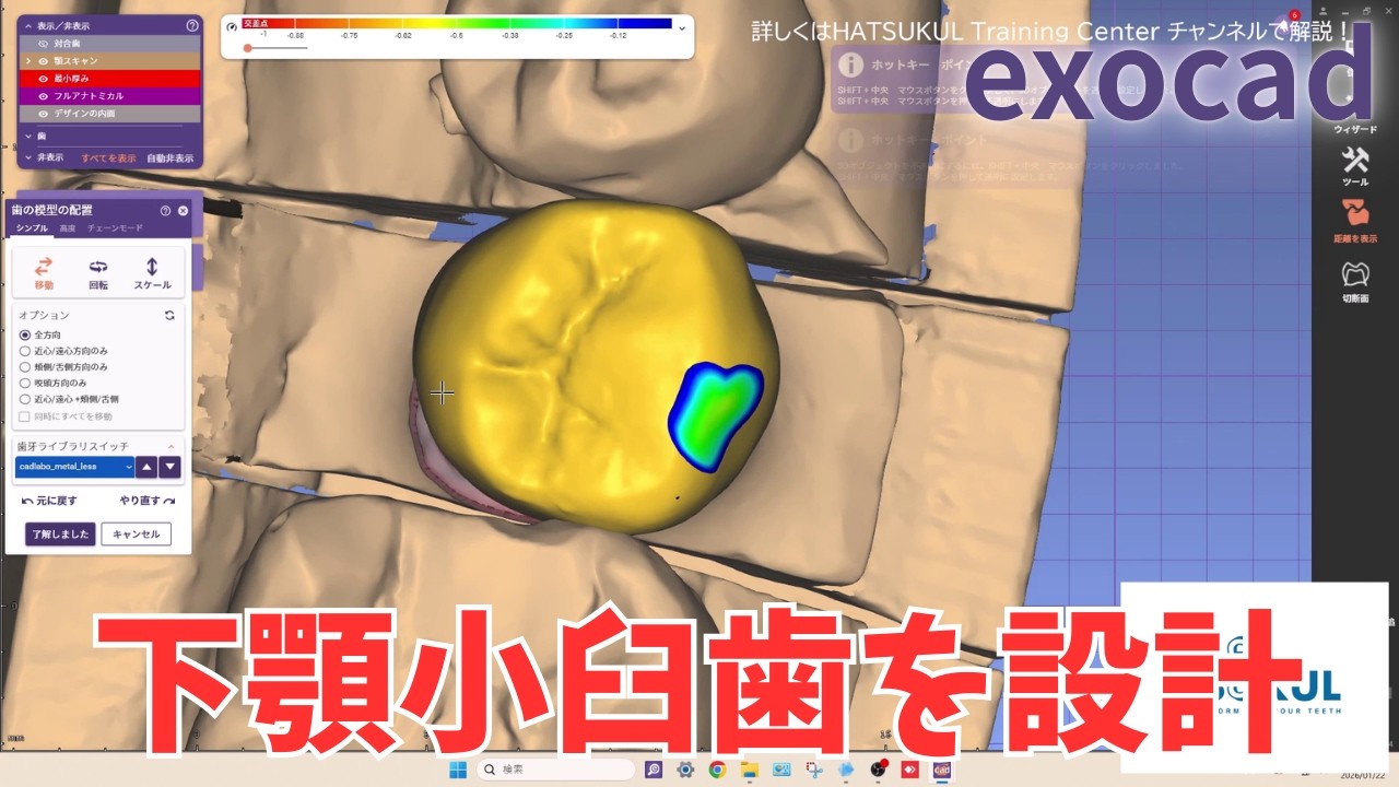 #318　exocad設計　下顎小臼歯を設計！（解説なし版）