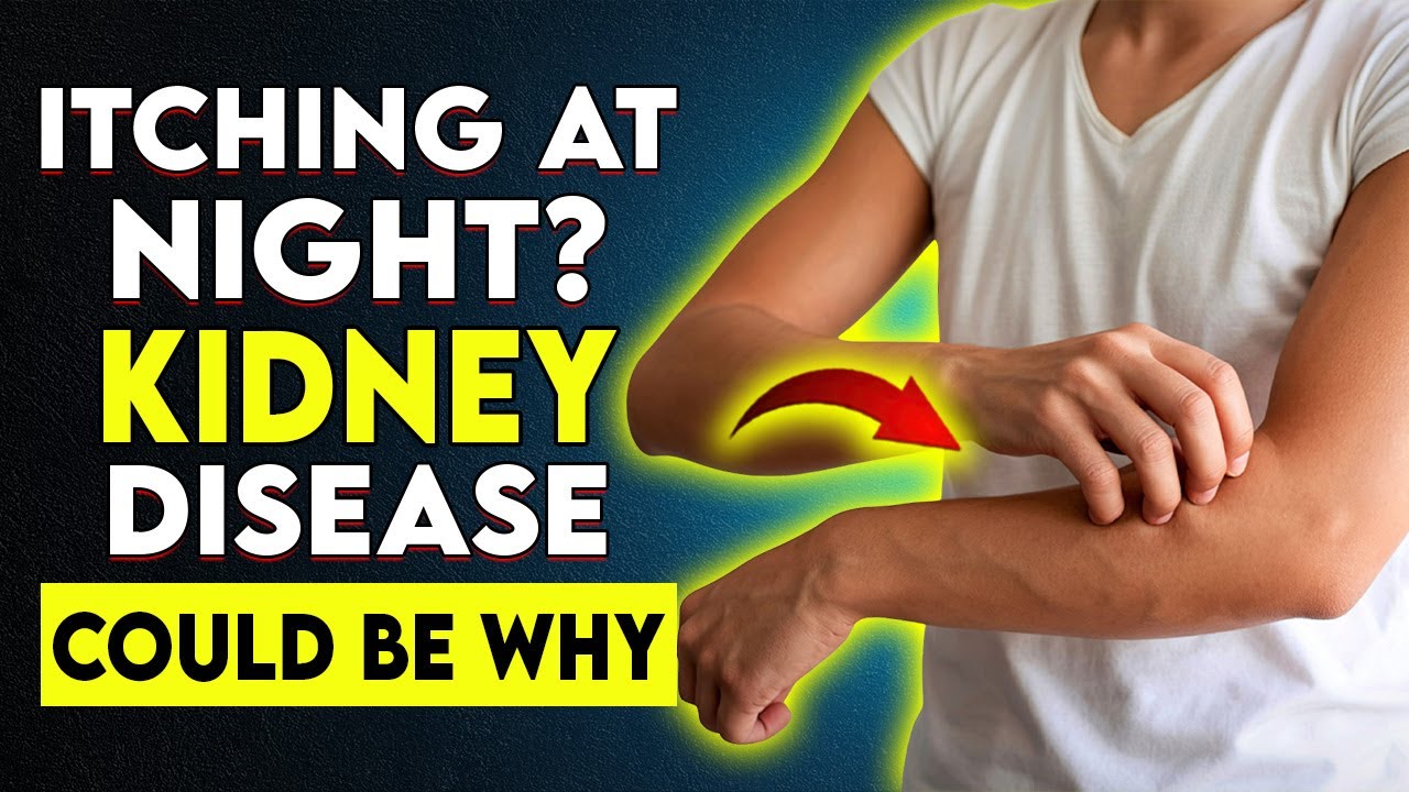 The Hidden Kidney Symptom No One Talks About (And How to Stop Itching!)