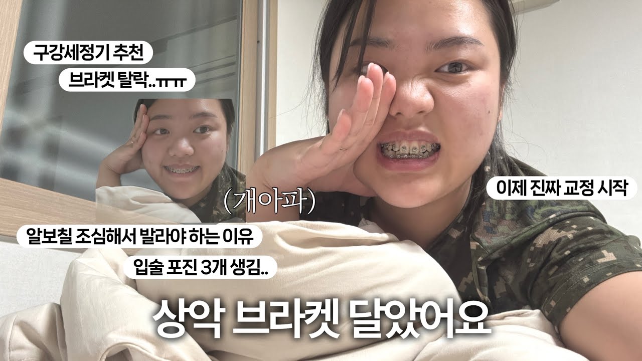 교정일기 3 • 구강세정기 추천‼️ • 치아교정 단점과 꿀팁