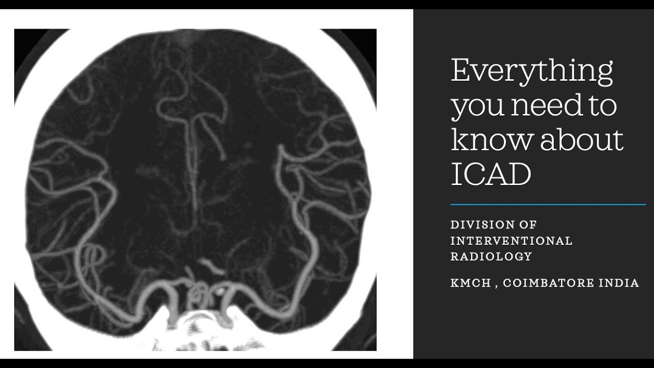 Everything you need to know about ICAD