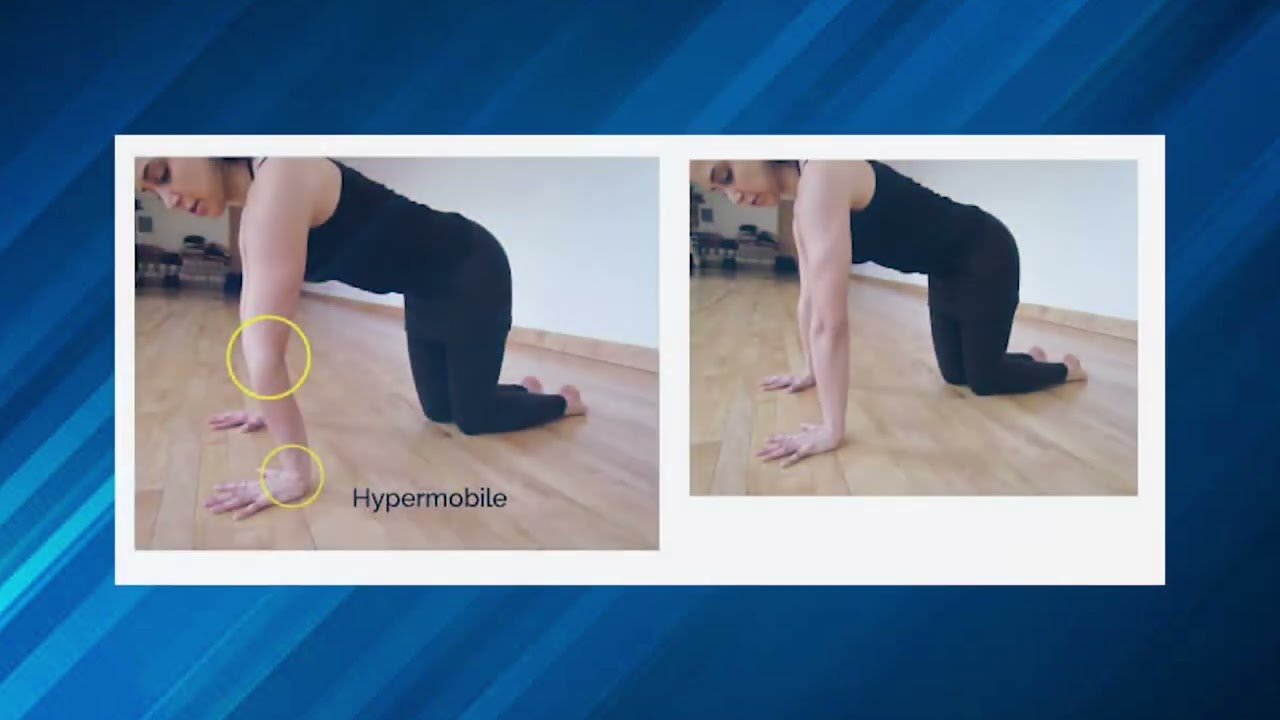 Flexible Joints: Tell me more!