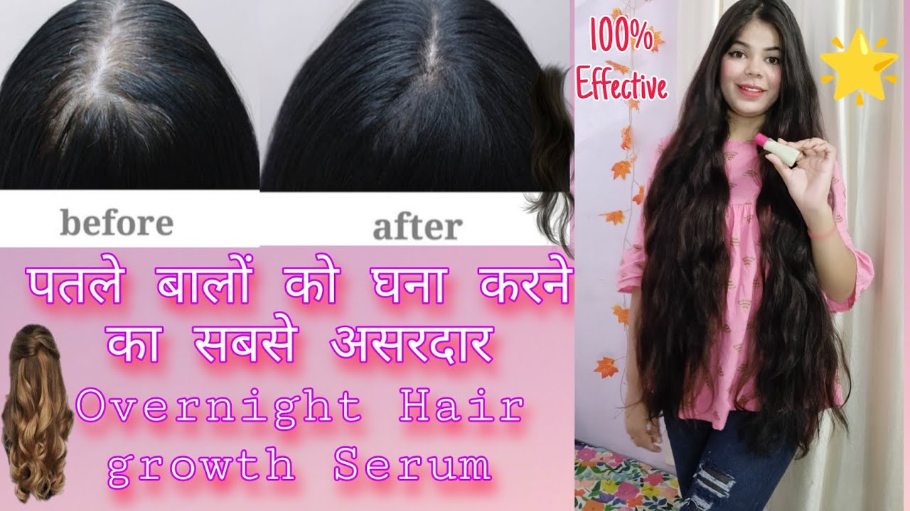 DIY Overnight Hair Growth Serum😍|*1Use Challenge*😱| Stop Hair fall, गंजेपन, Long Hair|#diyhairserum