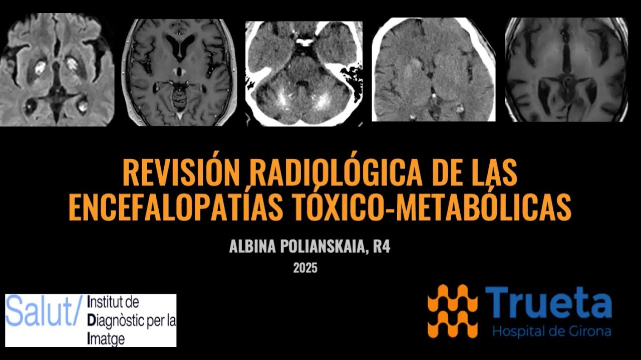 892. Revisión de las encefalopatías tóxico metabólicas