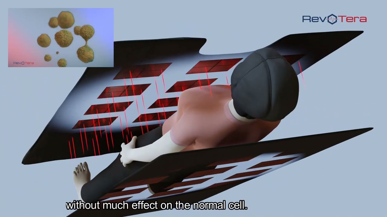 ECCT - How it works