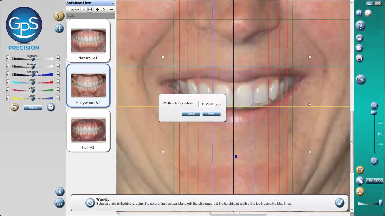 GPS presents the 3D Smile Designer