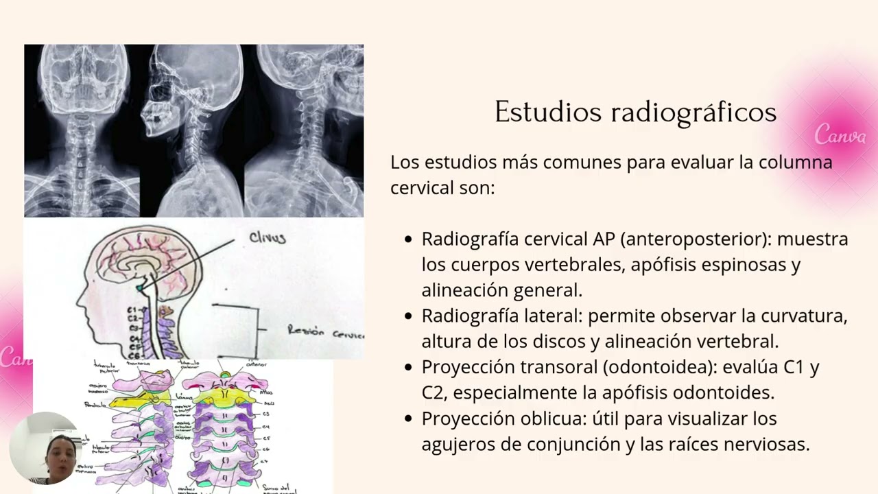 Columna cervical: Vertebras C1 - C7