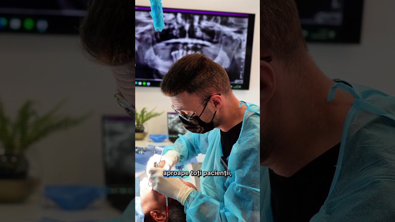 DE CE IMPLANTURI ANGULATE? #allon6implant  #allon4 #drmihaidascalu  #stomatolog  #dentist  #mddental