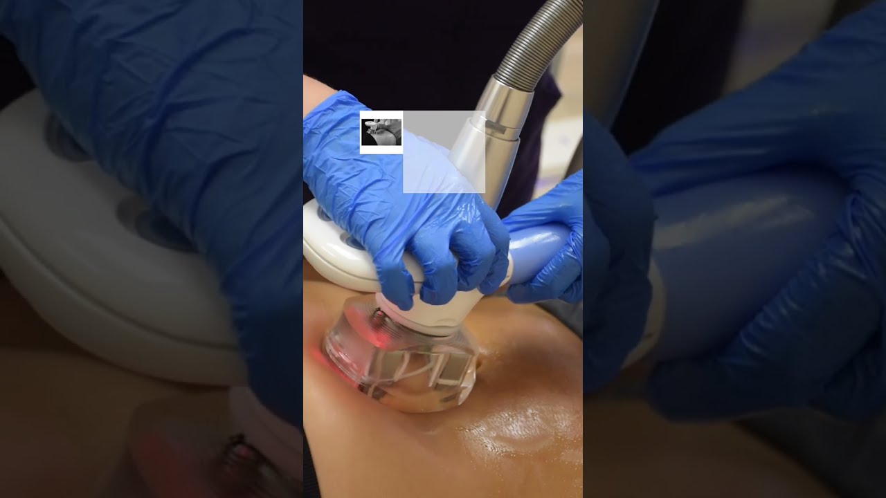 Nonsurgical Body Contouring Body Sculpting Skin Tightening Fat Reduction Eximia - Top Medical Spa NJ