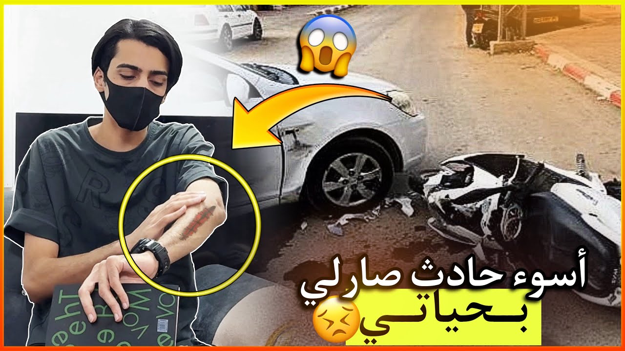 أسوء حادث صارلي بحياتي 😣😣!! (حلقة أعترافات)