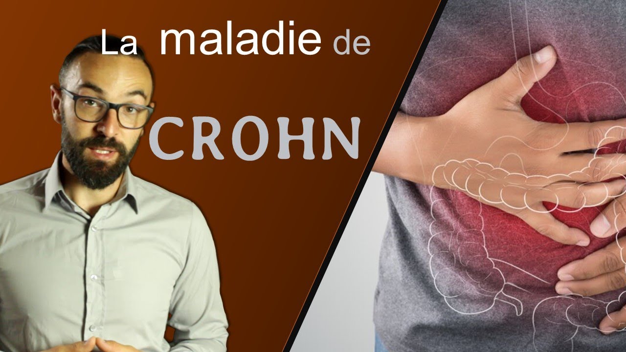 🩺 Tout savoir sur la maladie de CROHN