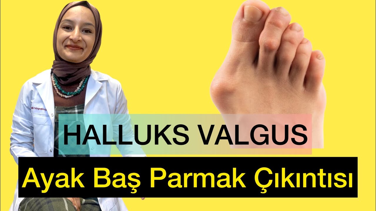 HALLUKS VALGUS EGZERSİZLERİ / AYAK BAŞ PARMAK ÇIKINTISI 
