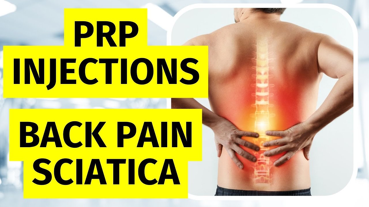 Инъекции PRP при болях в спине и ишиасе