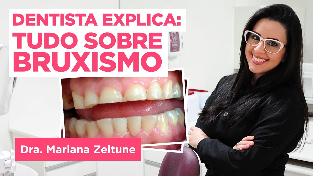 BRUXISMO: Causas, sintomas e tratamentos - Estresse, Placa Para Bruxismo, etc.
