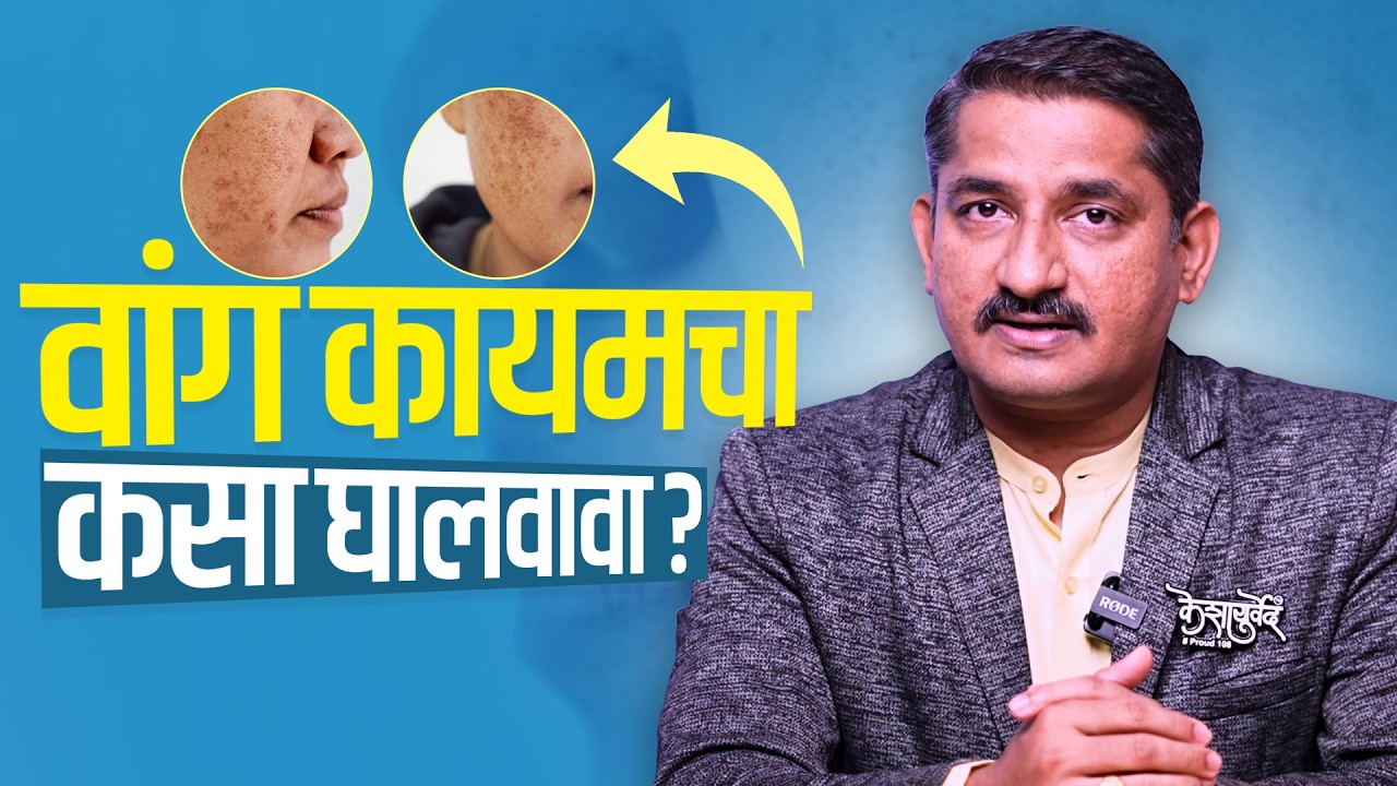 वांग कायमचा कसा घालवावा? | Face Pigmentation Treatment & Causes Explained | vaidya Harish Patankar