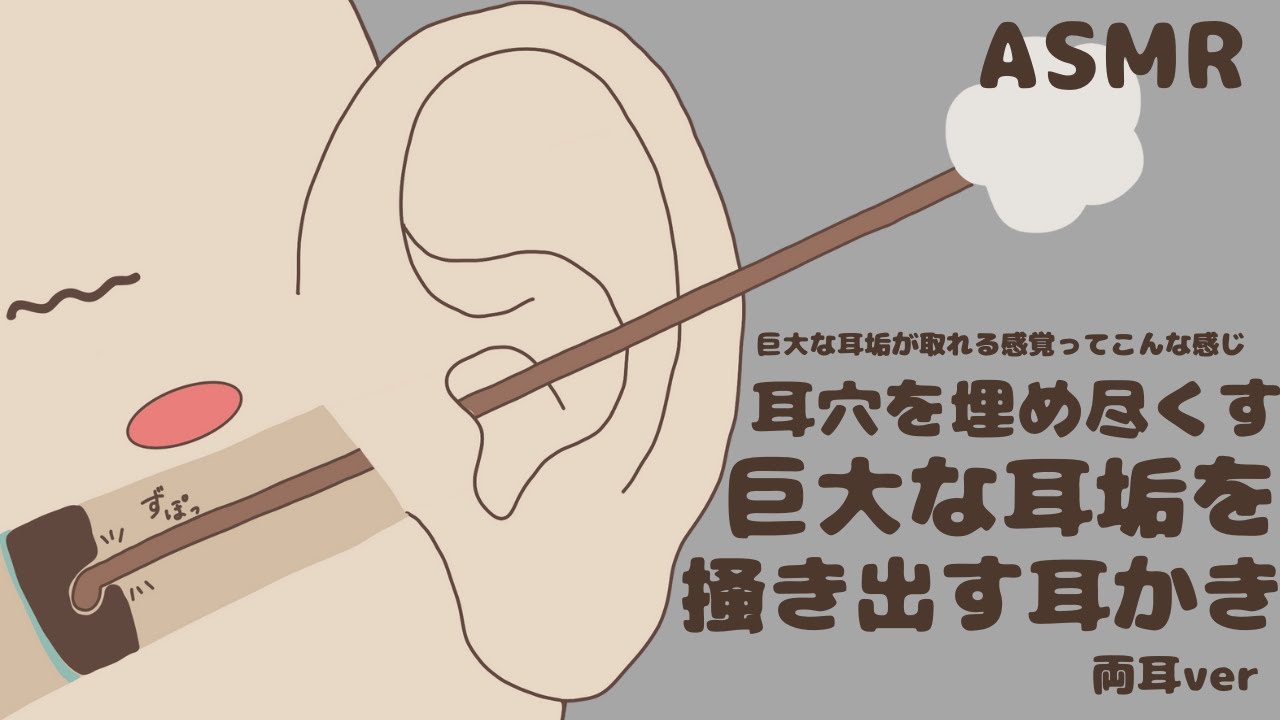 巨大な耳垢を掻き出す耳かき｜耳穴を埋め尽くすごっそり 両耳ver ASMR | No Talking