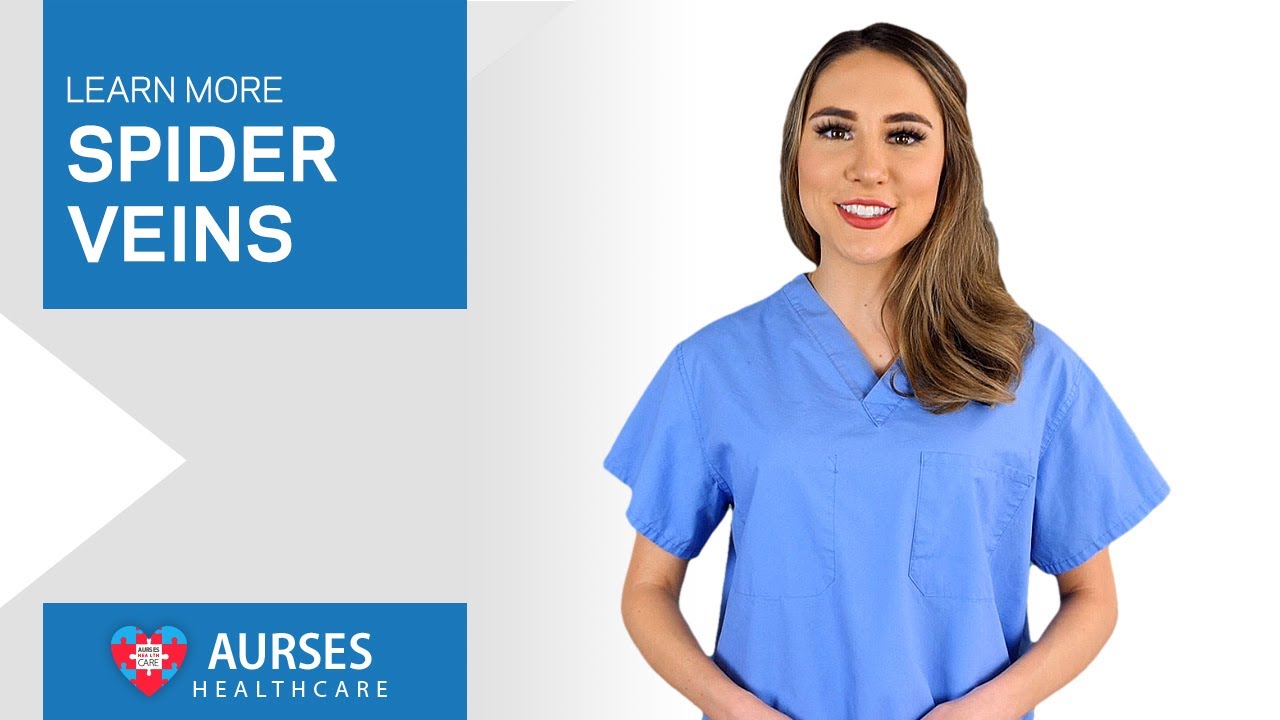 How To Remove Spider Veins Safely And Effectively! At Aurses Healthcare