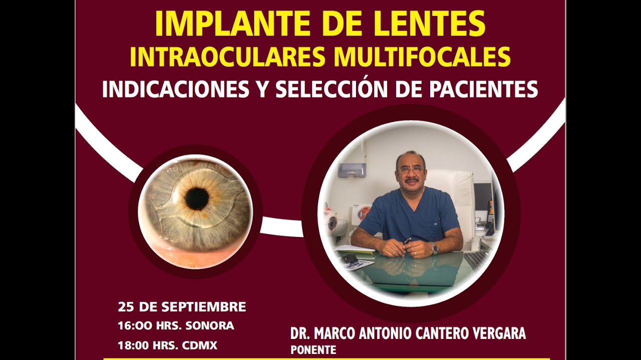 IMPLANTE DE LENTES INTRAOCULARES MULTIFOCALES