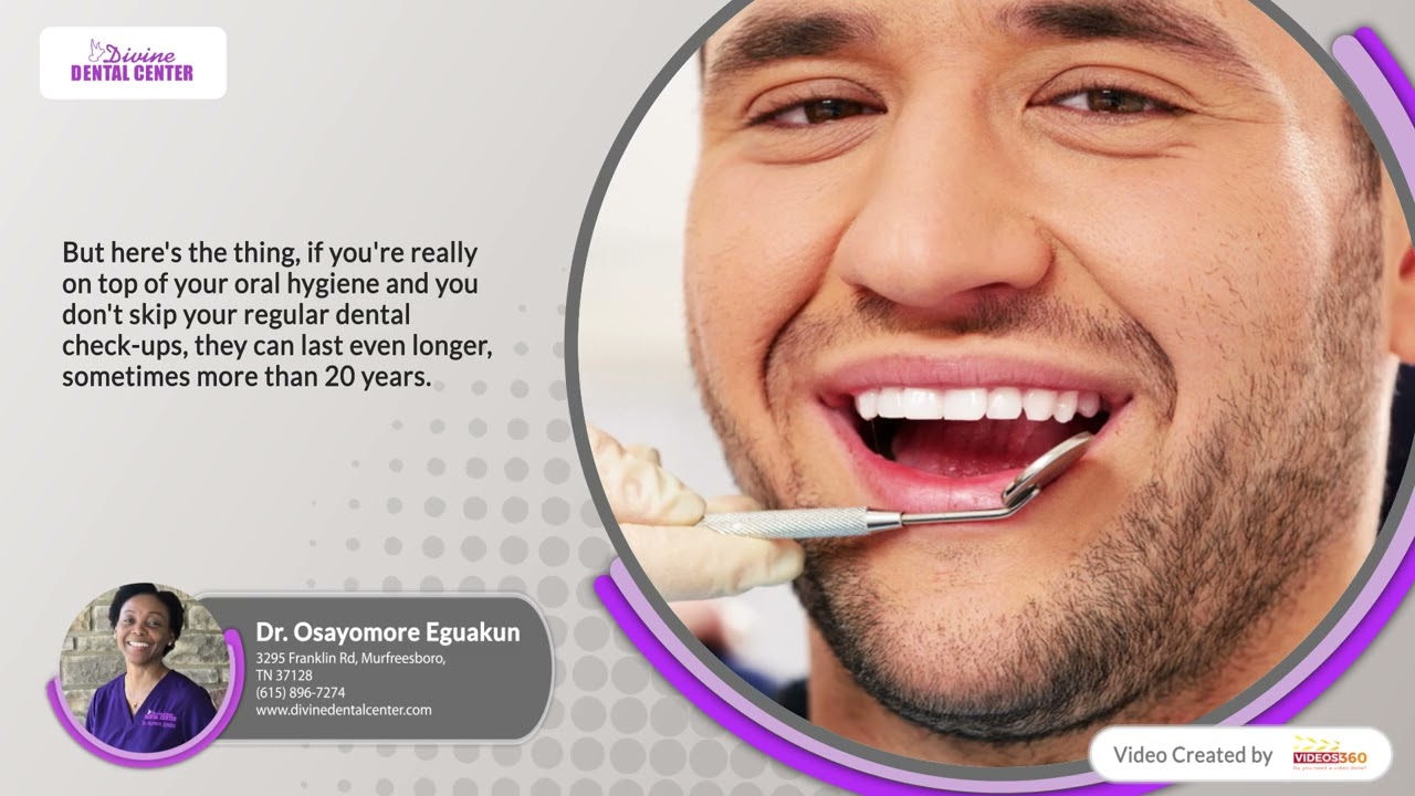 How Long Do Dental Crowns & Bridges Last?