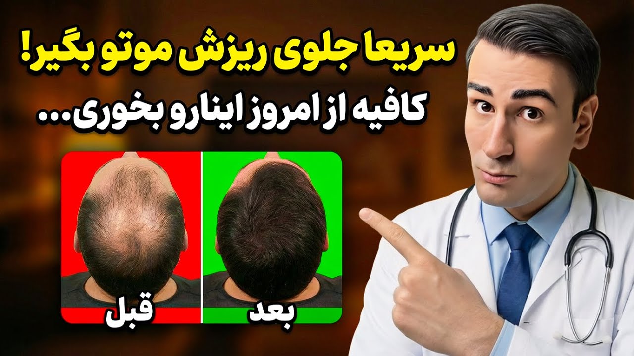 موهات داره میریزه؟ سریع این 5 تارو بخور تا دوباره پر مو بشی | نسخه خانگی دکتر شبیر برای رویش مجدد مو