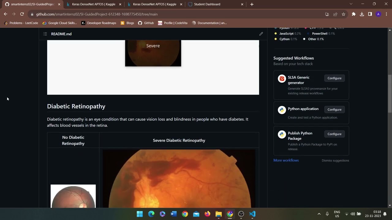 Diabetic Retinopathy Detection Using DenseNet121 model | APTOS 2019 Blindness Detection Dataset