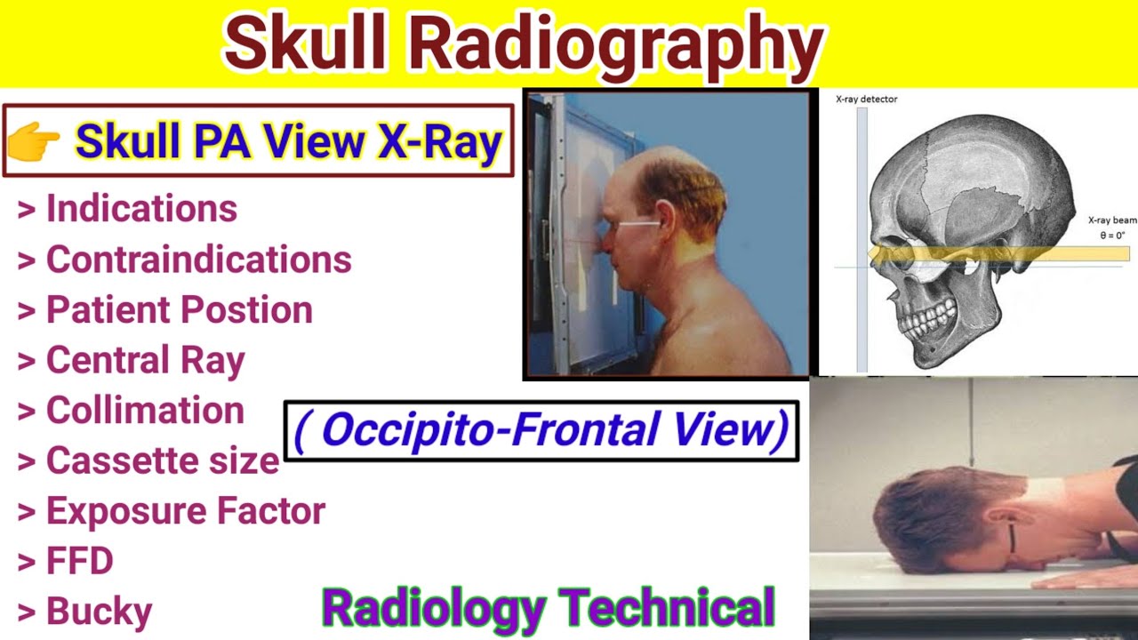 Skull Radiography # Skull PA view x-ray positioning # Occipito-frontal view # in Hindi #