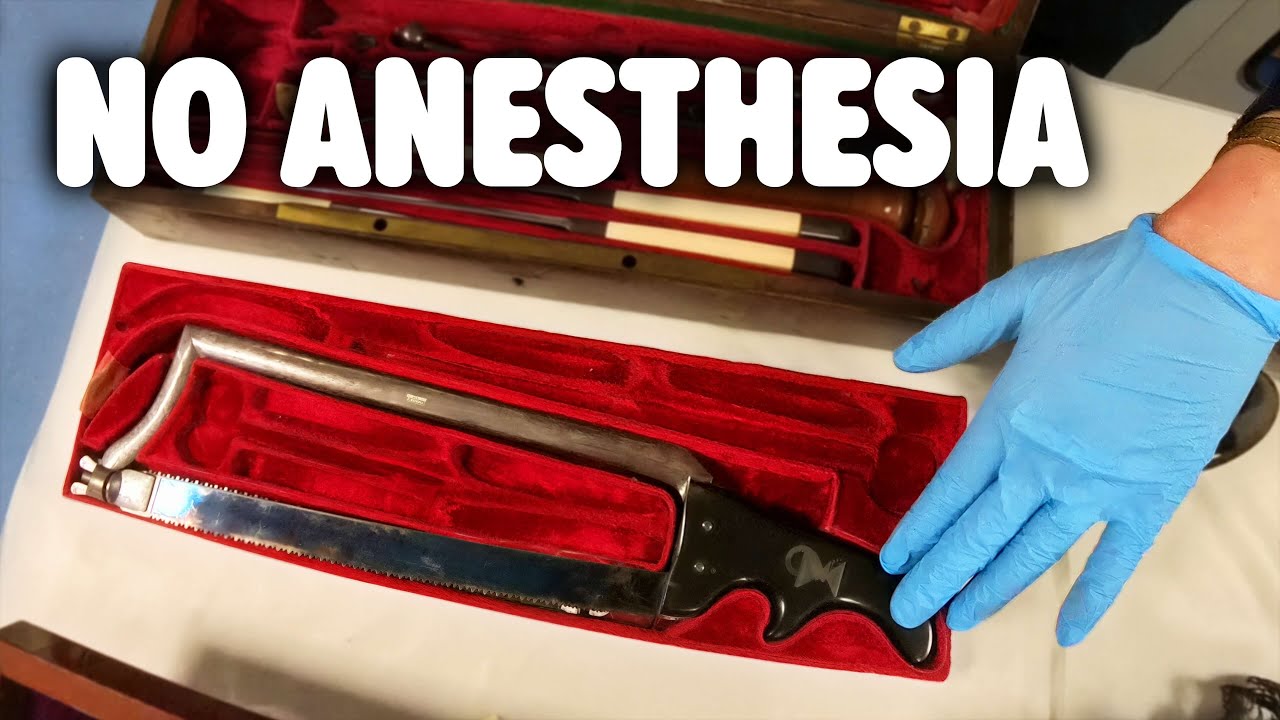 History's Strangest Medical Inventions