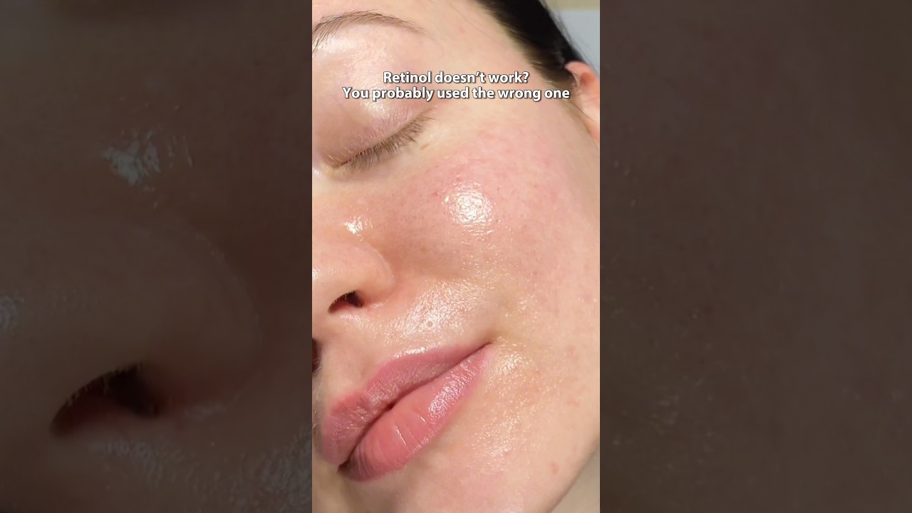 Retinol before and after | Real results, peeling, glow & how to use retinol for beginners