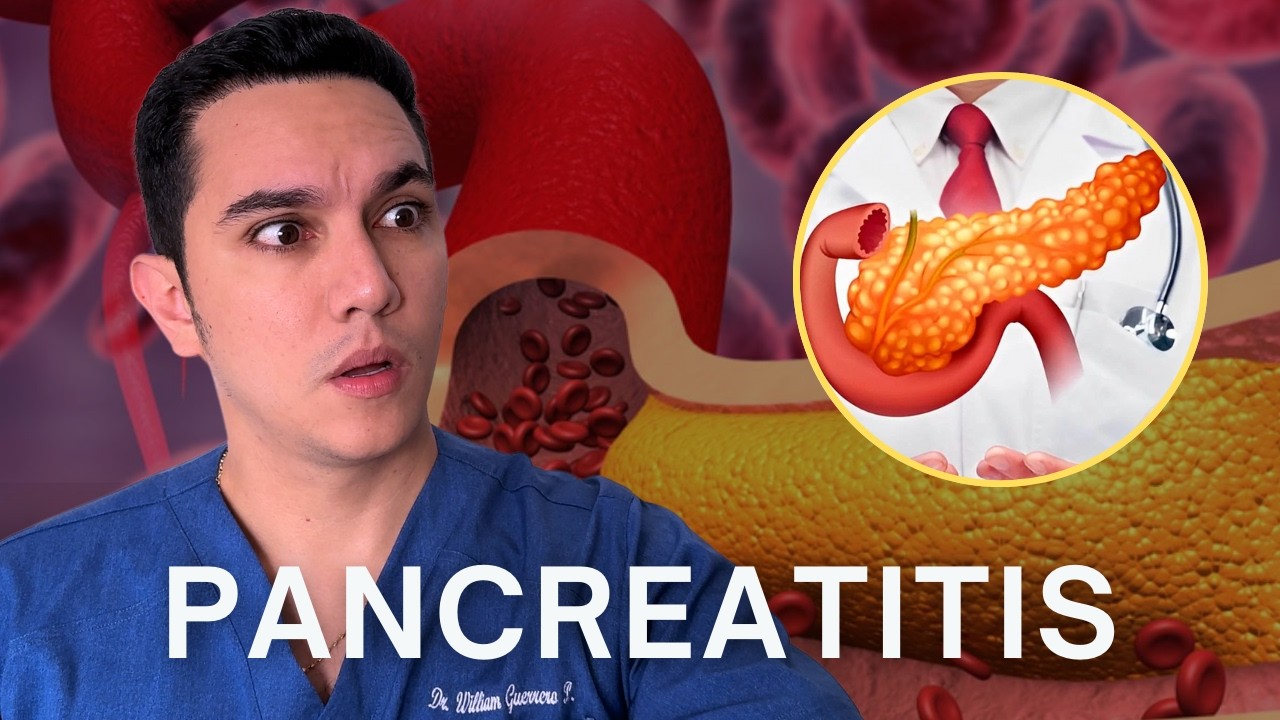 Los triglicéridos altos le causaron una pancreatitis grave que casi le cuesta la vida