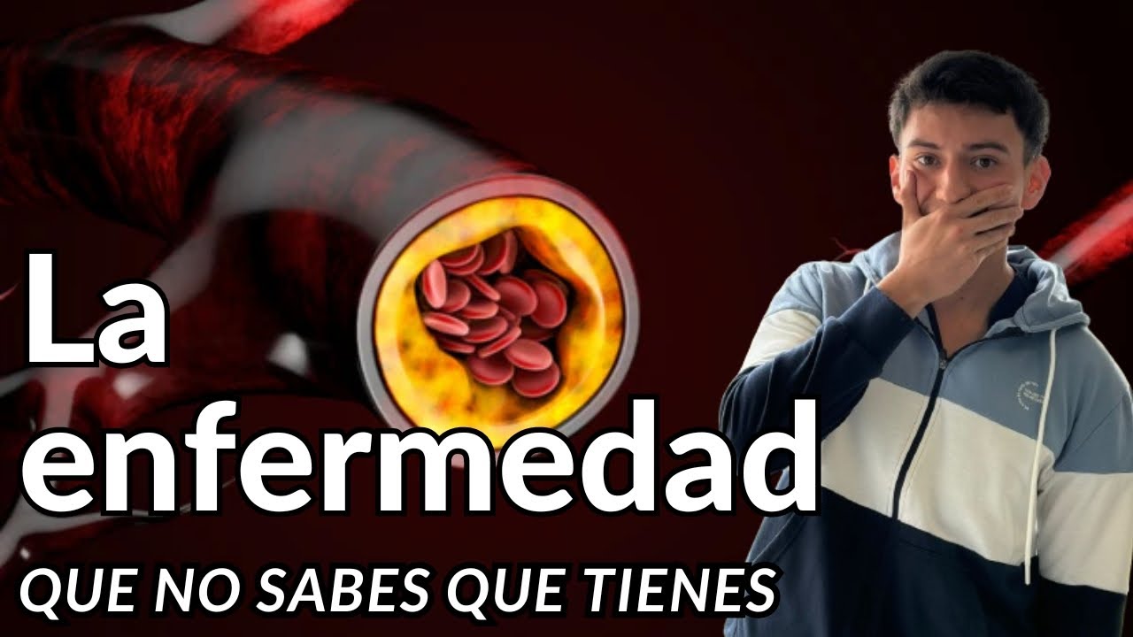 Ateroesclerosis - patología de los vasos sanguíneos. Robbins