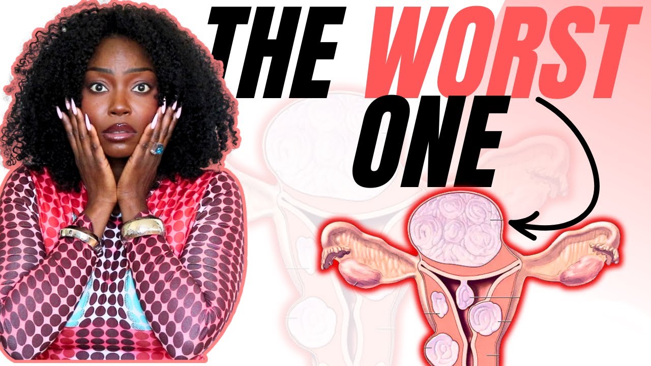 ⚠️ The 8 Types of Fibroids &mdash; And the One That Causes the Worst Symptoms