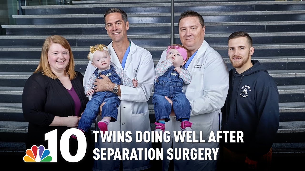 Girls Conjoined at the Head Doing Well a Year After Separation Surgery
