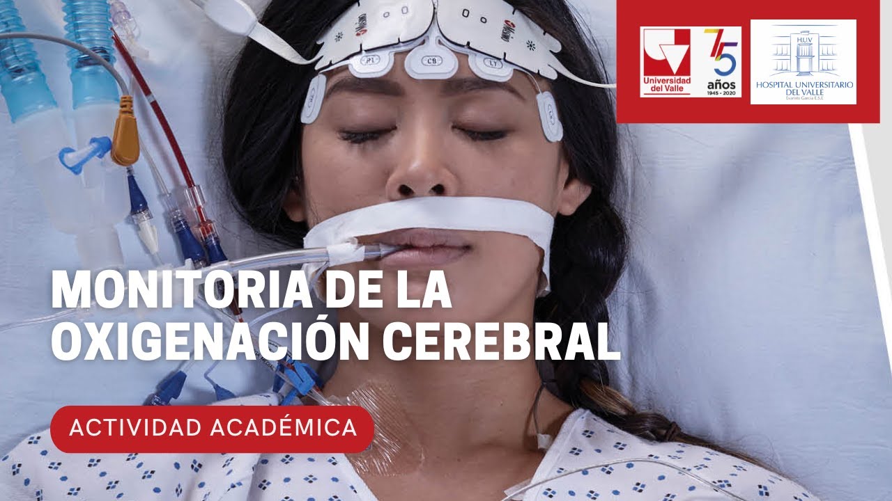Monitoria de la oxigenación cerebral